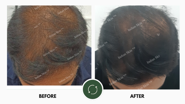 Before After