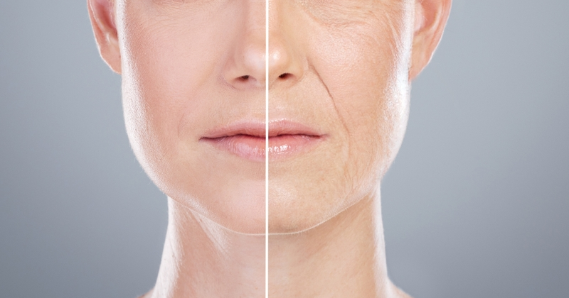 Anti Ageing Treatments