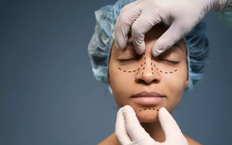 Dermatosurgery