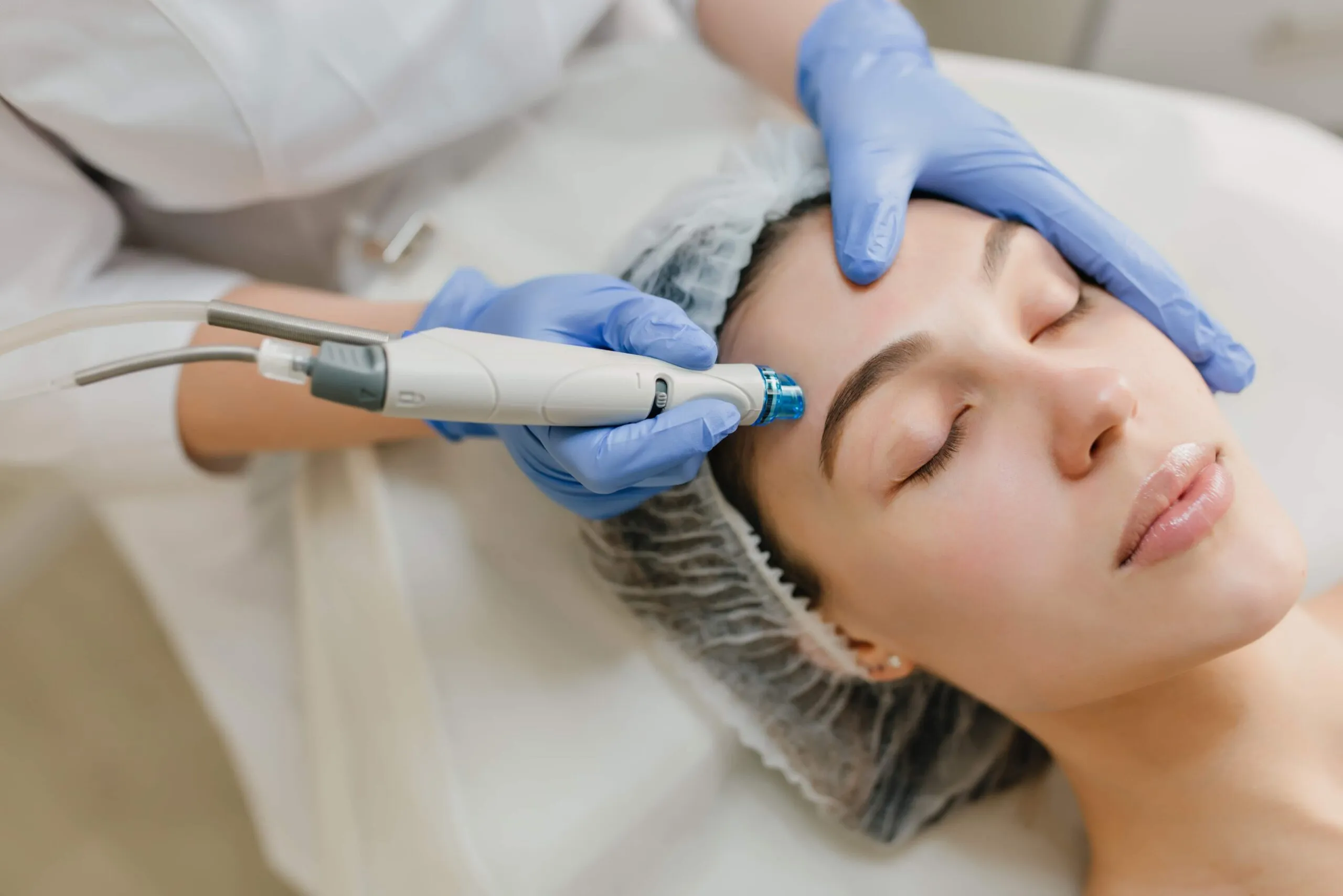 Mesotherapy Treatment