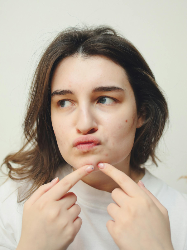 Skin Specialist in Chhindwara