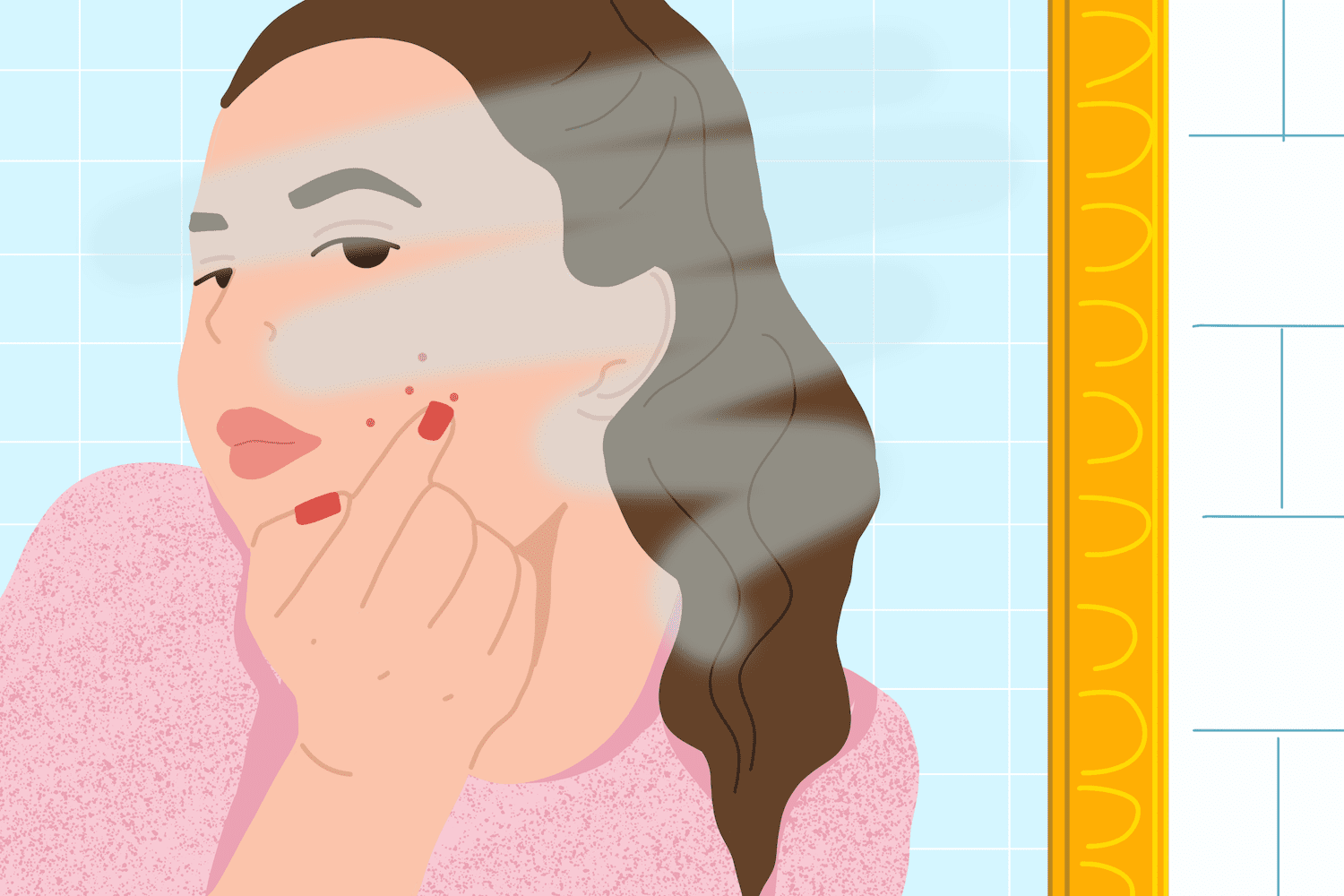 Acne Treatment in Raipur