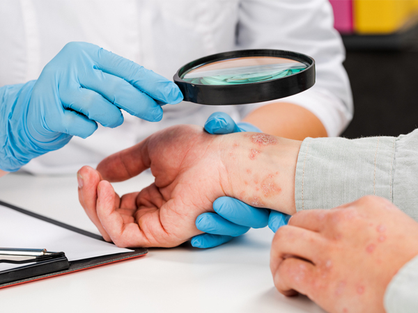 Best Online Dermatologist Consultation In India