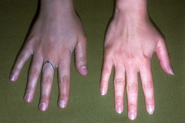 Charm Rog Visheshadhnya in Harda