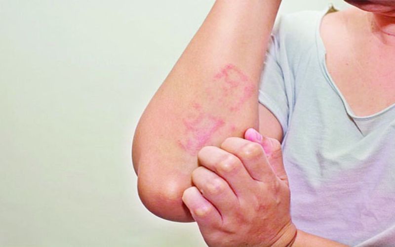 Charm Rog Vishetadhnya Doctor in Bhilai – Dr. Ayesha Faizan