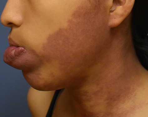 Charm Rog Vishetadhnya Doctor in Gondia