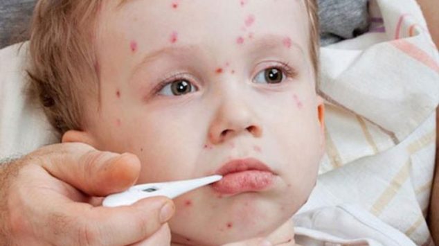 Child Skin Specialist In Nagpur