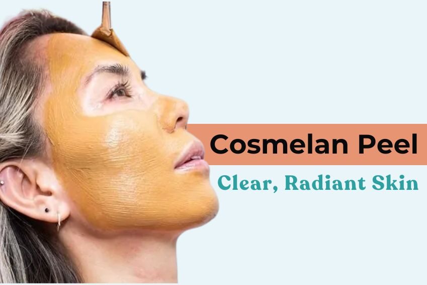 Cosmelan-Treatment-in nagpur