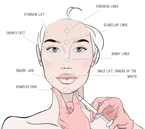 Filler Treatment in Balaghat