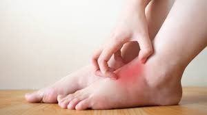 Fungal Infection Doctor in Betul – Dr. Ayesha Faizan