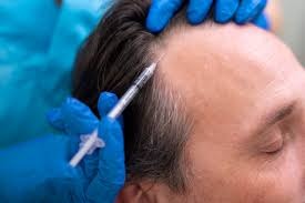 Hair Loss Doctor in Yavatmal
