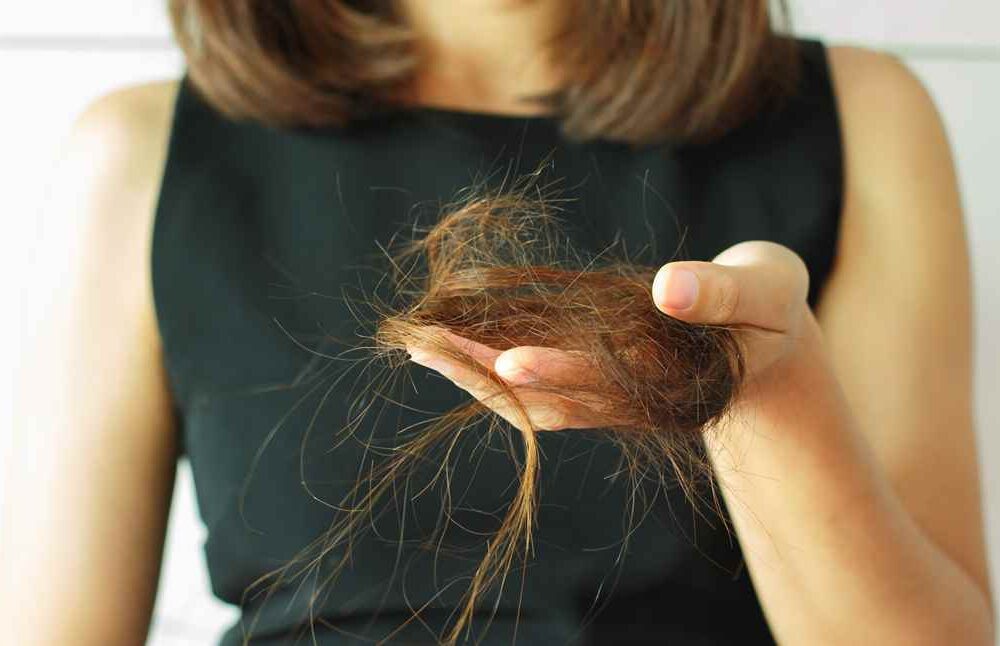 Hair Loss Doctor in Bhilai – Dr. Ayesha Faizan