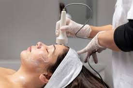 Best Acne Scar Treatment in Bhilai
