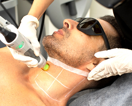 Laser Hair Removal In Balaghat