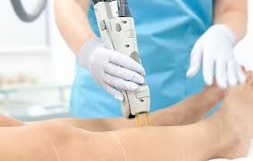 Laser Hair Removal in Amravati