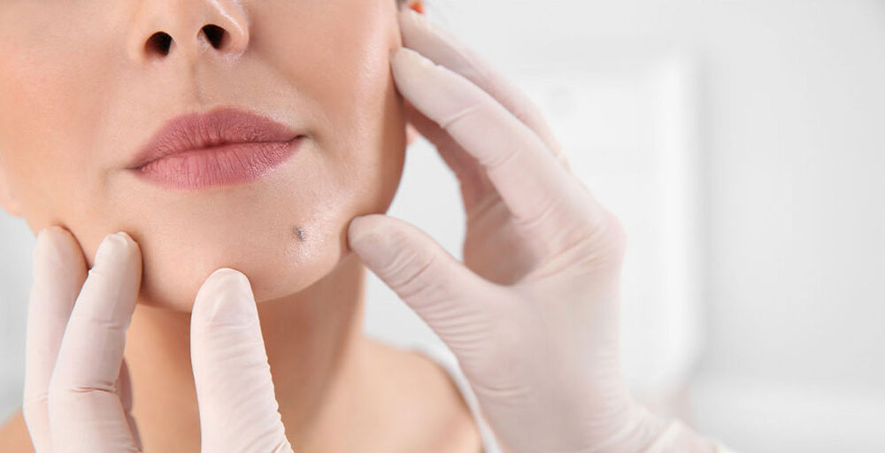 Best Dermatologist in Bhilai – Dr. Ayesha Faizan