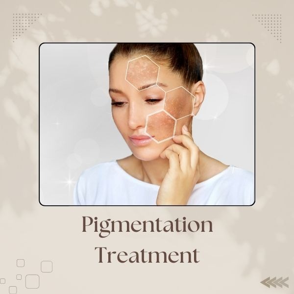 Pigmentation Treatment In Pune