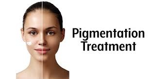 Pigmentation Treatment in Bhilai