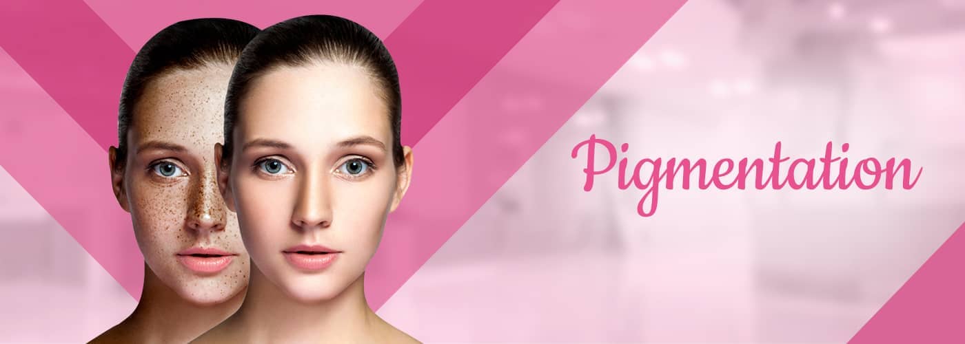Pigmentation Treatment in Raipur