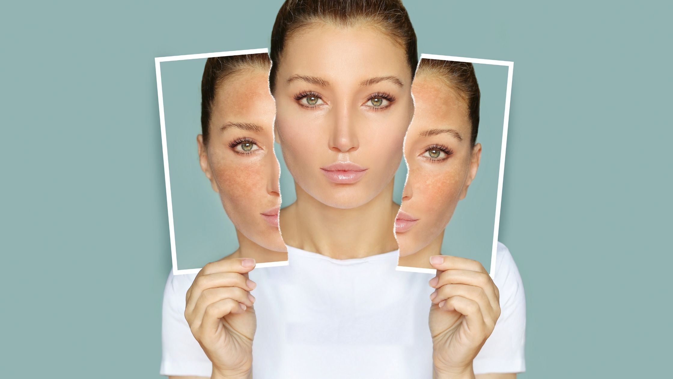 Skin Whitening Treatment In India