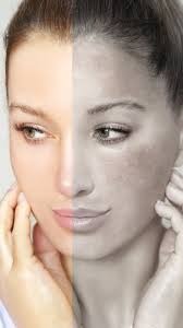 Skin Whitening Treatment in Ambikapur
