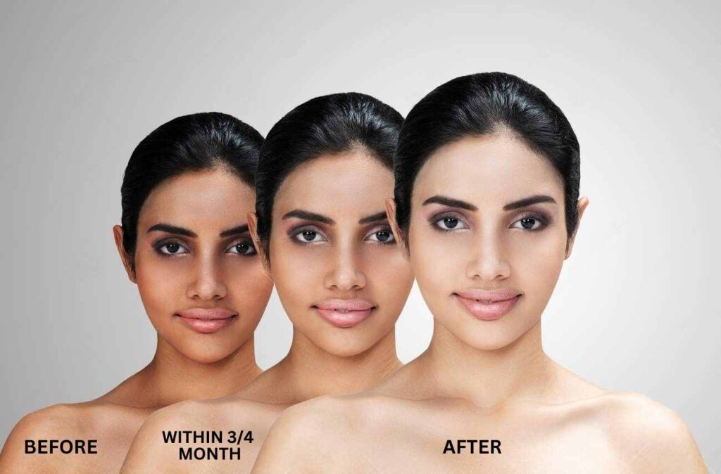 Skin Whitening Treatment in Bilaspur