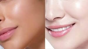 Skin Whitening Treatment in Betul – Dr. Ayesha Faizan