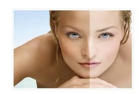 Skin Whitening Treatment in Chhattisgarh