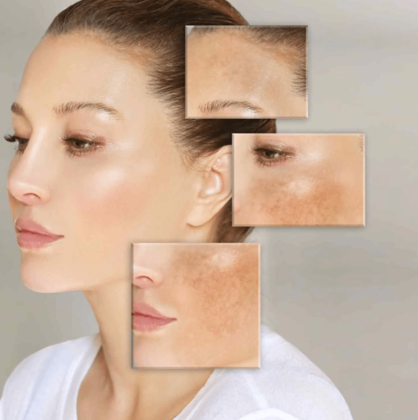 Pigmentation Treatment in Gadchiroli