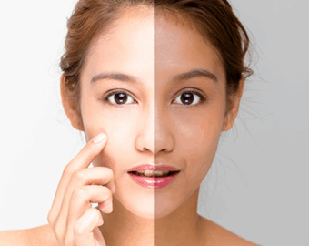 Skin whitening treatment in nagpur