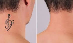 Tattoo Removal in Satna