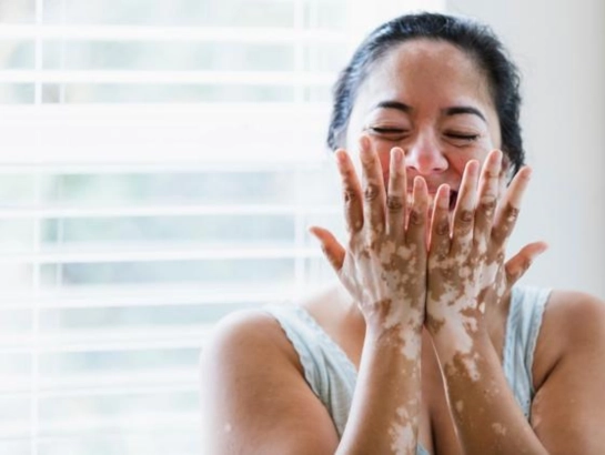 Charm Rog Vishetadhnya Doctor in Ambikapur