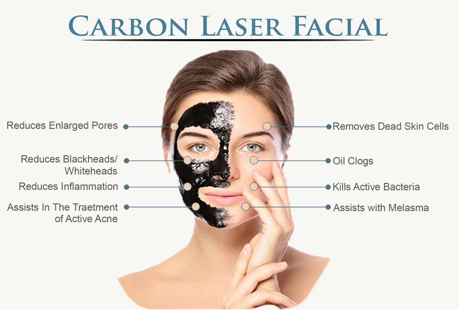 carbon laser facial
