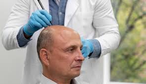 Best hair transplant doctor in Raipur