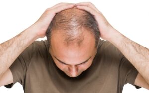 Certified Hair Transplant Surgeon in Raipur