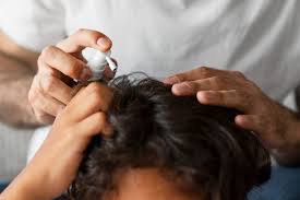 Common Hair Loss Solutions in Raipur
