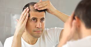 Cost of Hair Transplant in Raipur
