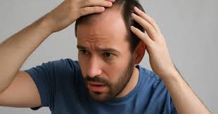 Hair Fall Treatment Near Me in Raipur