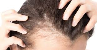 Hair Thinning Solution in India