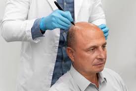Hair Transplant Surgeon in Raipur