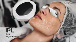 IPL Skin Treatment in Raipur