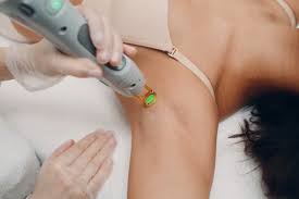 Laser Hair Removal Near Me in Raipur