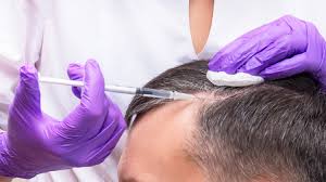 PRP Hair Treatment in Raipur