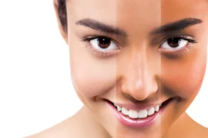 Skin Care Clinic in Raipur