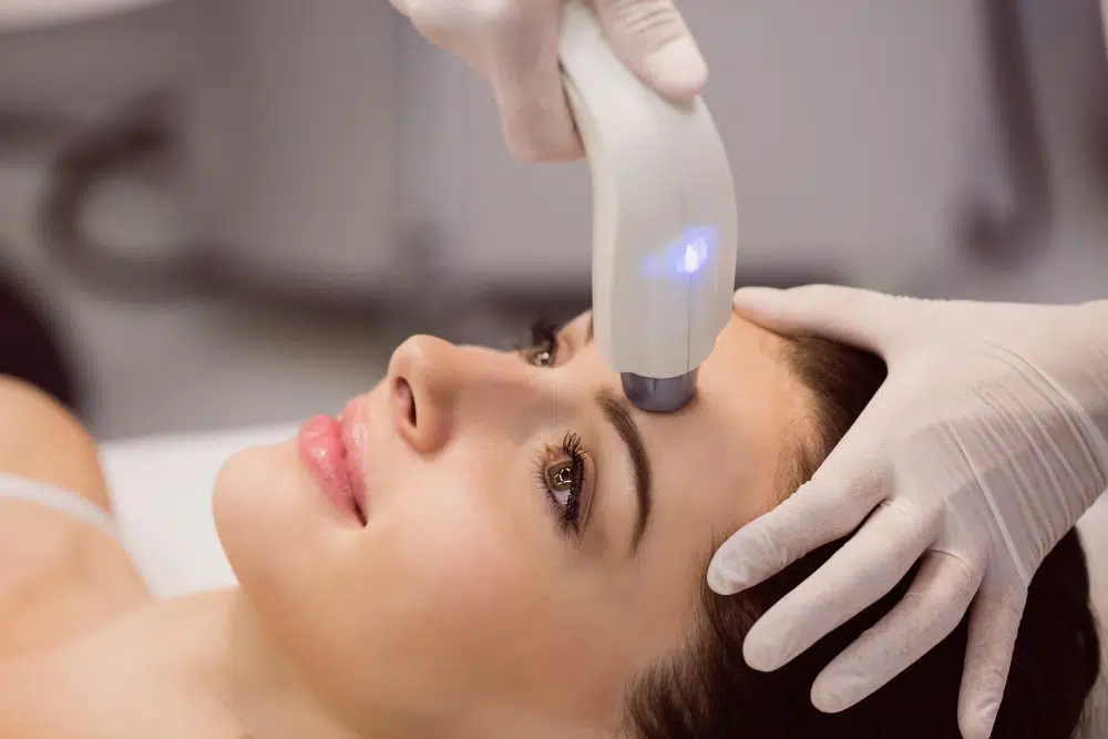 Collagen Pigment Laser